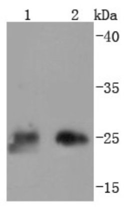 Thymidine Kinase 1 Rabbit anti-Human, Mouse, Clone: JF0970, Novus Biologicals