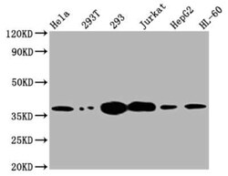 Thymidylate Synthase Antibody (2B2), Novus Biologicals 100 &mu;g; Unconjugated:Antibodies,