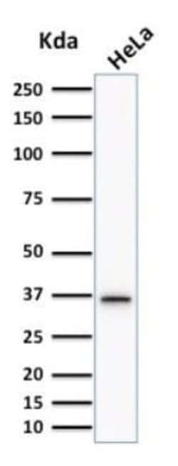 Thymidylate Synthase Mouse anti-Human, Clone: TYMS/1884, Novus Biologicals 20 &mu;g | Buy Online | Novus Biologicals | Fisher Scientific