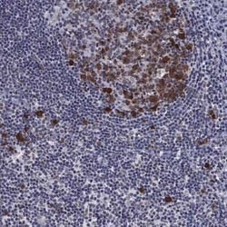 Thymidylate Synthase Rabbit anti-Human, Polyclonal, Novus Biologicals:Antibodies:Primary