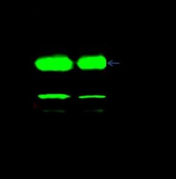 Thymidylate Synthase Antibody, Novus Biologicals 100 &mu;g | Buy Online | Novus Biologicals | Fisher Scientific