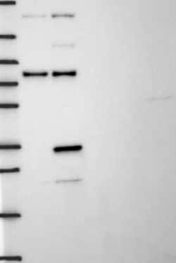 Thymidylate Synthase Rabbit anti-Human, Polyclonal, Novus Biologicals:Antibodies:Primary