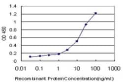 Thymosin alpha 1 Antibody (1G8), Novus Biologicals 0.1 mg, Unconjugated:Antibodies