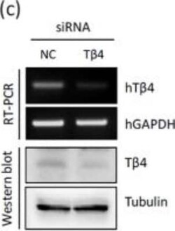 Thymosin beta 4 Antibody, Novus Biologicals 0.05 mg | Buy Online | Novus Biologicals | Fisher Scientific