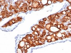 Thyroid Peroxidase Rabbit anti-Human, Clone: TPO/6417R, Novus Biologicals:Antibodies:Primary