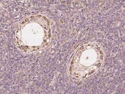 Thyroid receptor-interacting protein 13 Antibody, Novus Biologicals 100