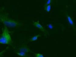 Tie-2 Rabbit anti-Human, Clone: 116, Novus Biologicals 100 &mu;g; Unconjugated:Antibodies,