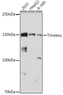Timeless Rabbit anti-Human, Clone: 6D4L2, Novus Biologicals 20 &mu;g | Buy Online | Novus Biologicals | Fisher Scientific