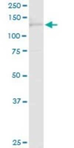 Timeless Antibody, Novus Biologicals 0.1 mg | Buy Online | Novus Biologicals | Fisher Scientific