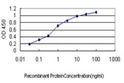 Titin Antibody (2B3), Novus Biologicals 0.1 mg, Unconjugated:Antibodies,