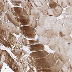 Titin Antibody, Novus Biologicals 100 &mu;g; Unconjugated:Antikörper