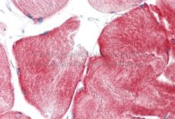 Tnk1 Rabbit anti-Human, Polyclonal, Novus Biologicals 0.1ml; Unconjugated:Antibodies,