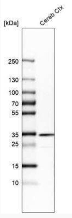 Tollip Antibody, Novus Biologicals 0.1 mL | Buy Online | Novus Biologicals | Fisher Scientific