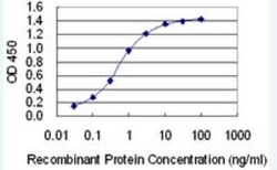 TopBP1 Antibody (6D12), Novus Biologicals 100 &mu;g | Buy Online | Novus Biologicals | Fisher Scientific