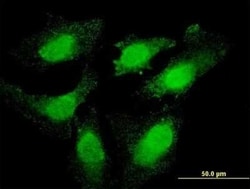 Topo III beta Antibody (1H4), Novus Biologicals 0.1 mg | Buy Online | Novus Biologicals | Fisher Scientific
