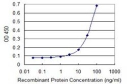Topo III beta Antibody (1H4), Novus Biologicals 0.1 mg | Buy Online | Novus Biologicals | Fisher Scientific