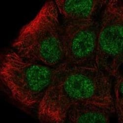 Topo III beta Rabbit anti-Human, Polyclonal, Novus Biologicals:Antibodies:Primary