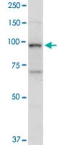 Topoisomerase I Antibody (1A1), Novus Biologicals 0.1 mg | Buy Online | Novus Biologicals | Fisher Scientific