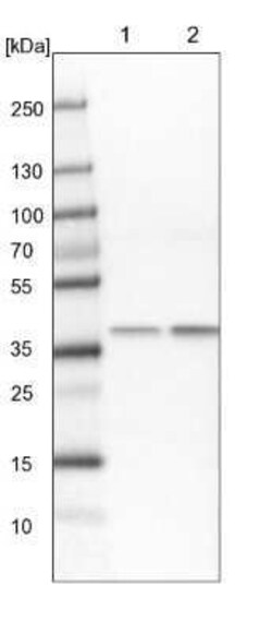 Transaldolase 1 Antibody, Novus Biologicals 25 &mu;L | Buy Online | Novus Biologicals | Fisher Scientific