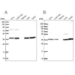 Transaldolase 1 Antibody, Novus Biologicals 25 &mu;L | Buy Online | Novus Biologicals | Fisher Scientific