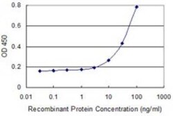 Transcobalamin II Antibody (2F4), Novus Biologicals 0.1 mg | Buy Online | Novus Biologicals | Fisher Scientific