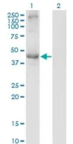 Transcobalamin II Antibody (2F4), Novus Biologicals 0.1 mg | Buy Online | Novus Biologicals | Fisher Scientific