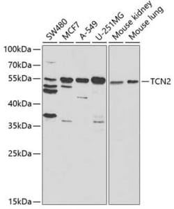 Transcobalamin II Antibody - BSA Free, Novus Biologicals 0.02 mL; Unconjugated:Antibodies,