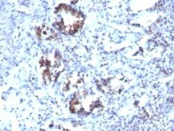 Transgelin/TAGLN/SM22 alpha Antibody (SPM606), Novus Biologicals™