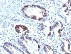 Transgelin/TAGLN/SM22 alpha Antibody (TAGLN/247), Novus Biologicals:Antibodies:Primary