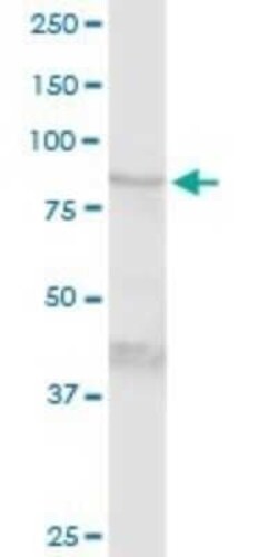 Transglutaminase 1/TGM1 Antibody, Novus Biologicals 0.1 mg | Buy Online | Novus Biologicals | Fisher Scientific