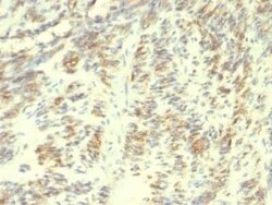 Transglutaminase 2/TGM2 Antibody (TGM2/419), Novus Biologicals:Antibodies:Primary