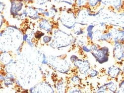 Transglutaminase 2/TGM2 Antibody (SPM358), Novus Biologicals 0.1mg; Unlabeled:Antibodies,