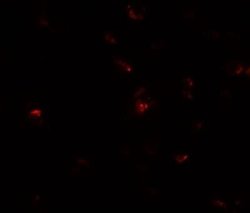Transglutaminase 7/TGM7 Antibody - BSA Free, Novus Biologicals 0.1 mg;