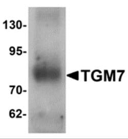 Transglutaminase 7/TGM7 Antibody - BSA Free, Novus Biologicals 0.1 mg;