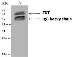 Transketolase Antibody, Novus Biologicals:Antibodies:Primary Antibodies