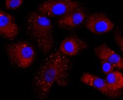Transthyretin/Prealbumin Rabbit anti-Human, Clone: JM11-43, Novus Biologicals