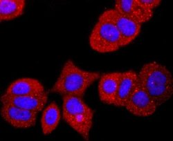 Transthyretin/Prealbumin Rabbit anti-Human, Clone: JM11-43, Novus Biologicals