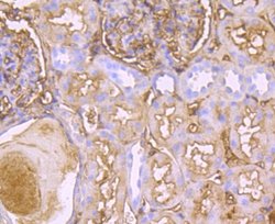 Transthyretin/Prealbumin Rabbit anti-Human, Clone: JM11-43, Novus Biologicals