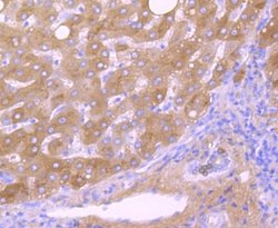 Transthyretin/Prealbumin Rabbit anti-Human, Clone: JM11-43, Novus Biologicals
