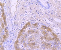 Transthyretin/Prealbumin Rabbit anti-Human, Clone: JM11-43, Novus Biologicals