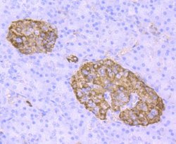 Transthyretin/Prealbumin Rabbit anti-Human, Clone: JM11-43, Novus Biologicals