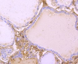Transthyretin/Prealbumin Rabbit anti-Human, Clone: JM11-43, Novus Biologicals