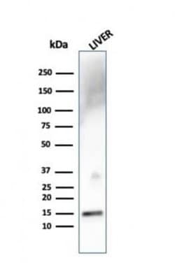 Transthyretin/Prealbumin Mouse anti-Human, Clone: TTR/4292, Novus Biologicals:Antibodies:Primary