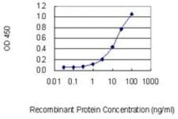 Novus Biologicals Treacher Collins syndrome protein Antibody (8H3), Novus