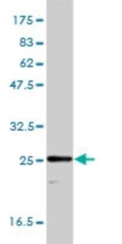 Triosephosphate isomerase Antibody (1D10-2E2), Novus Biologicals 0.1 mg | Buy Online | Novus Biologicals | Fisher Scientific