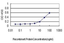 Tripeptidyl-Peptidase I/TPP1 Antibody (3B1), Novus Biologicals 0.1 mg | Buy Online | Novus Biologicals | Fisher Scientific