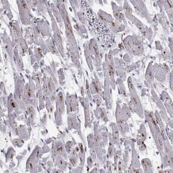Tripeptidyl-Peptidase I/TPP1 Antibody, Novus Biologicals:Antibodies:Primary