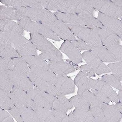 Tripeptidyl-Peptidase I/TPP1 Antibody, Novus Biologicals:Antibodies:Primary