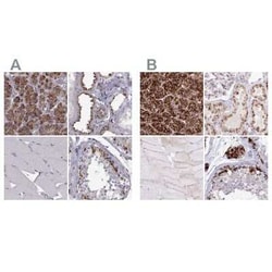 Tripeptidyl-Peptidase I/TPP1 Antibody, Novus Biologicals:Antibodies:Primary