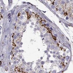 Tripeptidyl-Peptidase I/TPP1 Antibody, Novus Biologicals:Antibodies:Primary